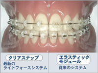 ���C�g�t�H�[�X�V�X�e��